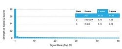 Ret Antibody (RET/2599) - Azide and BSA Free, Novus Biologicals 100 &mu;g;
